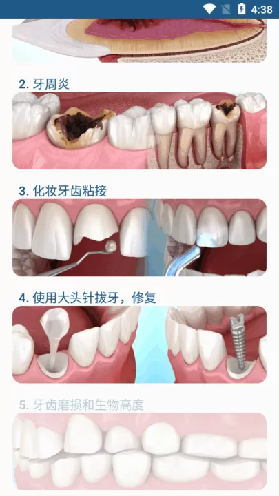 Dental Illustrations下载免费版图2