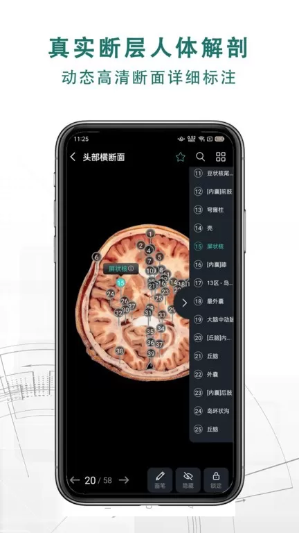 掌上3D解剖下载最新版本图0