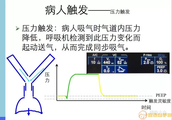 snippv呼吸机模式