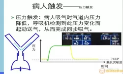 snippv呼吸机模式