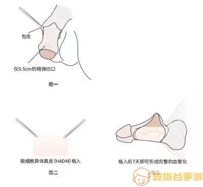 海绵体摸着像鱼鳞一样