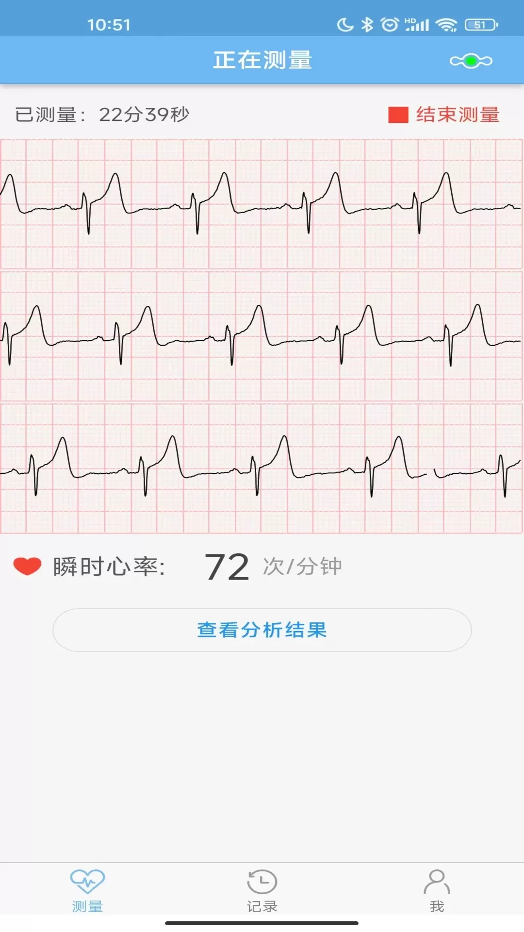 数维康心电正版下载图2