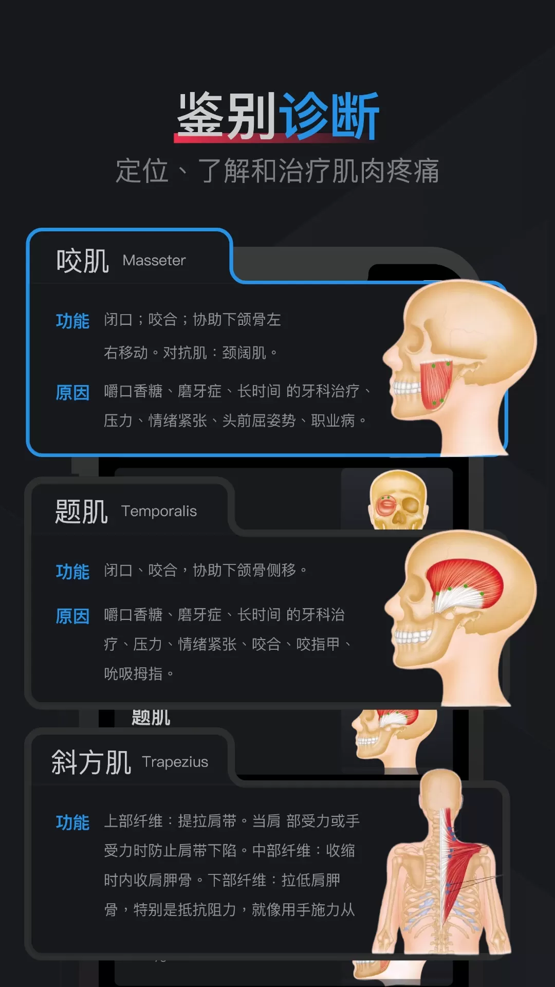 肌肉激痛点图谱安卓最新版图1